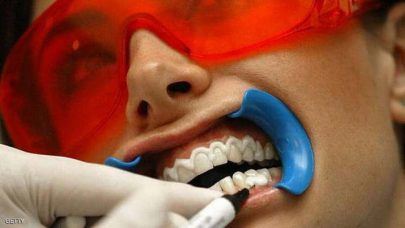 “تبييض الأسنان” يسبب أضراراً كبيرة بصحة الفم