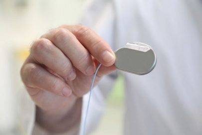 مستشفى راشد يستخدم أحدث جيل لأجهزة علاج نوبات الصرع