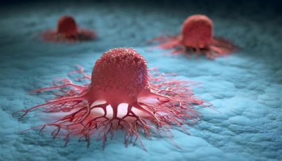 الأرق يضعف الخلايا المحاربة للسرطان