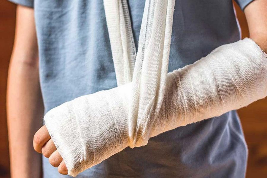 الأسبرين يُثبت فاعليته كمضاد للتجلط في إصابات كسور العظام