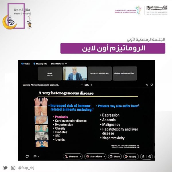 جلسة افتراضية توعوية لمرضى الروماتيزم وأمراض المفاصل في رمضان