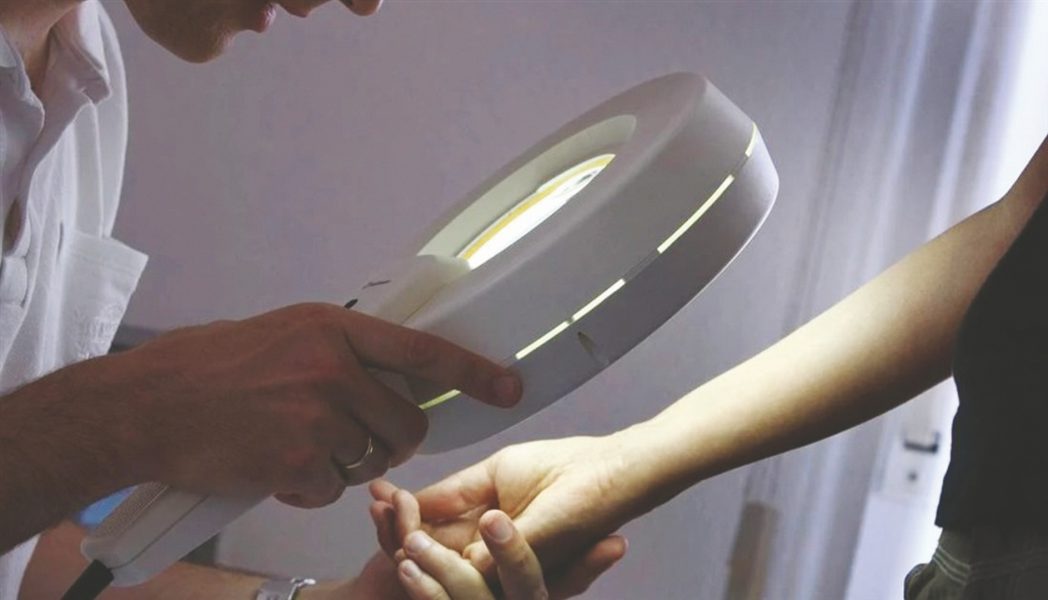 التغيرات الطارئة على الشامة تنذر بسرطان الجلد